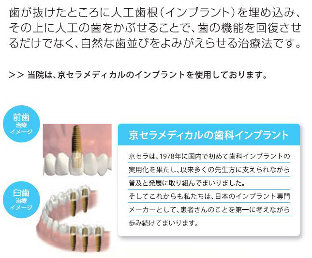 京セラメディカルのインプラント