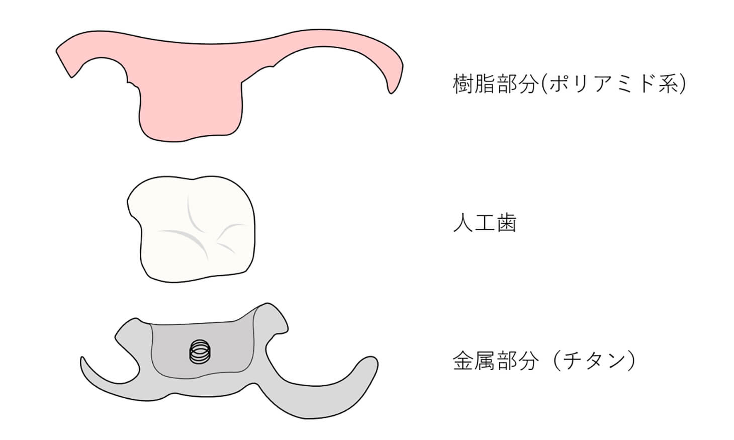 新しい入れ歯（義歯）コンティースデンチャーとは